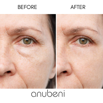 Under Eye Red Light Patches